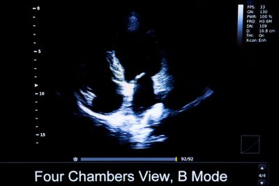Colourful image of homan heart ultrasound monitor
