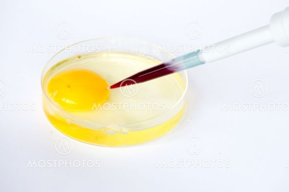 In vitro fertilization