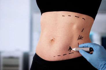 Female Surgeon Performing Liposuction Surgery