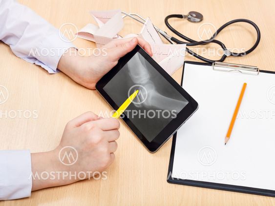 doctor examines X-ray picture of human knee joint