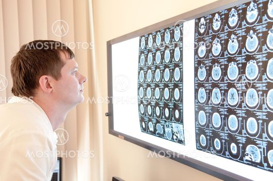 Doctor with CT scan films