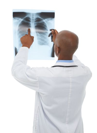 Doctor, xray scan and person review MRI results for lung...