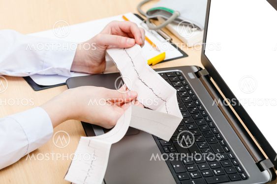 physician examines patient electrocardiogram