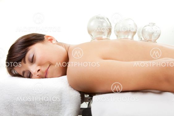 Female Receiving Acupuncture Cupping Treatment