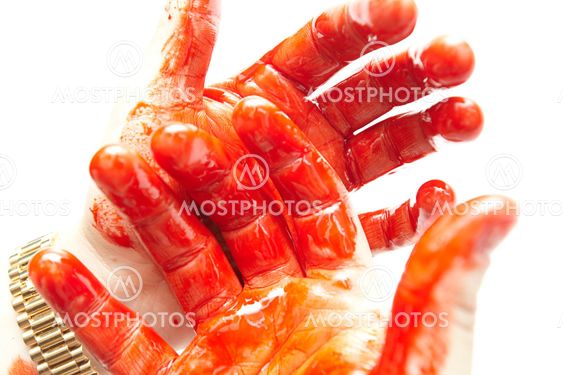 bloody hands