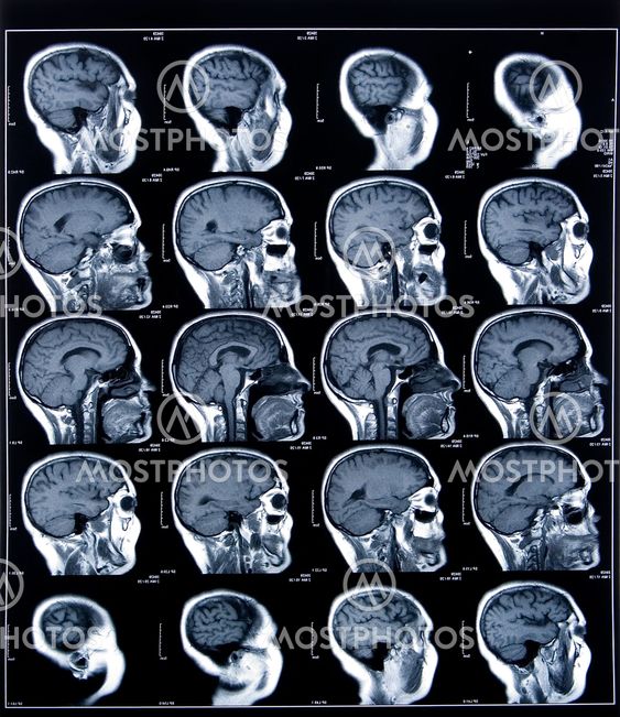 health medical mri