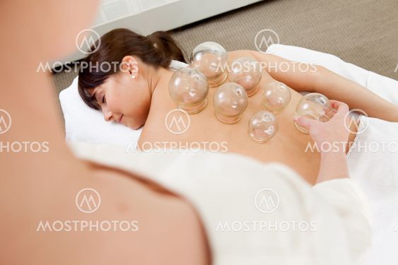 Woman Receiving Cupping Treatment