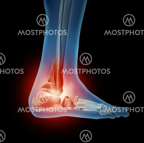 Ankle Foot Pain