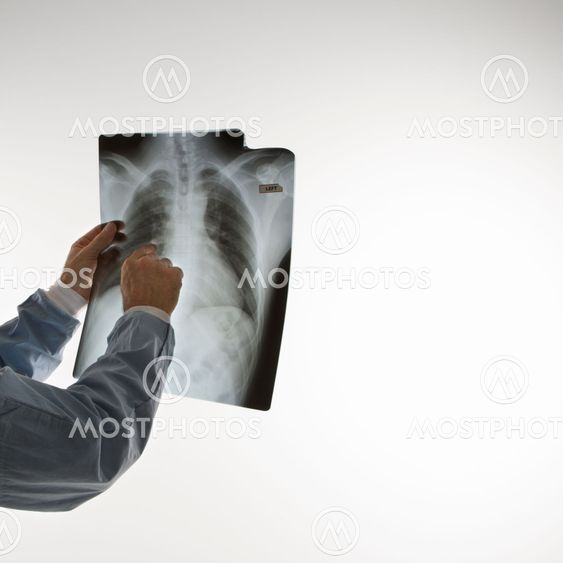Doctor reading x ray.