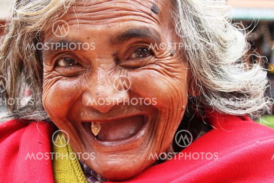 Happy smile with one tooth