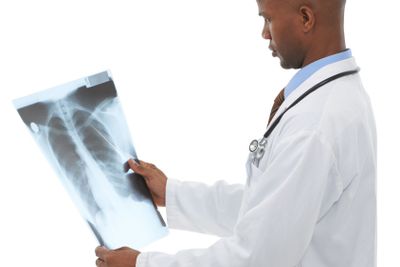 Doctor, black man or check xray scan for lung cancer...