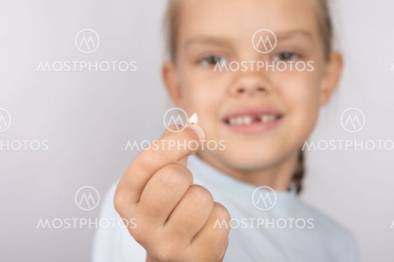 Six year old girl showing her fallen front upper teeth