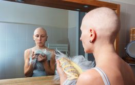 Sad, bald female contemplates wearing wig tired of cancer
