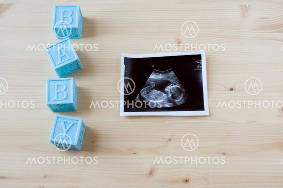 Sonogram on wood