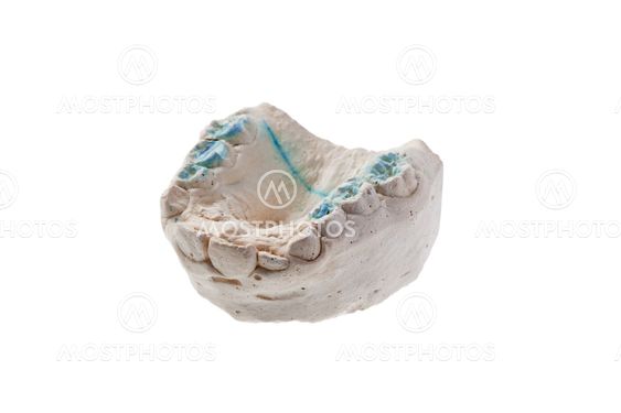 cast of the lower jaw isolated