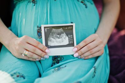 Happy pregnant couple. Close up photoshoot ultrasound