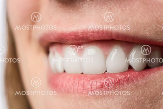 Closeup white teeth of young woman