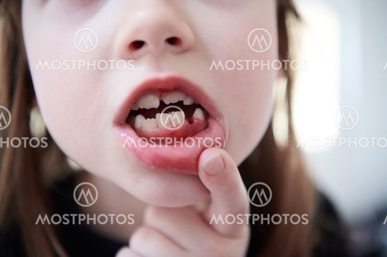 little girl without tooth smiling