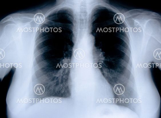 health medical x ray
