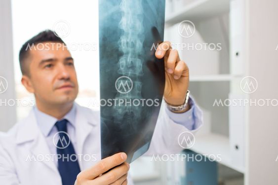close up of doctor in white coat looking at x-ray