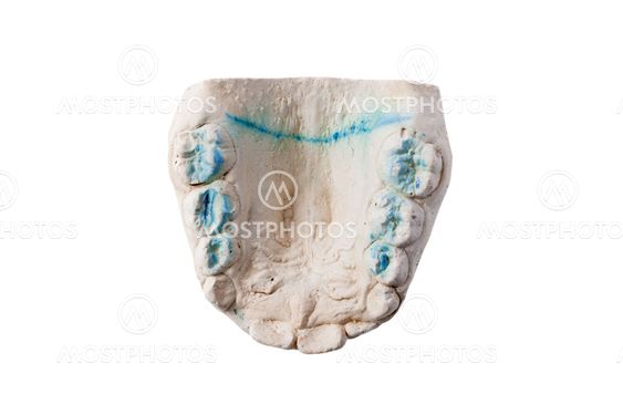 cast of the lower jaw