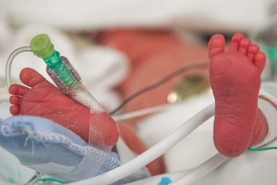 Premature Baby's Feet