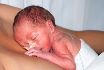 premature baby