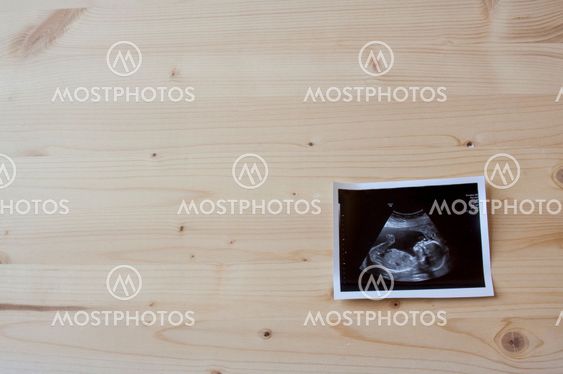 Sonogram on wood
