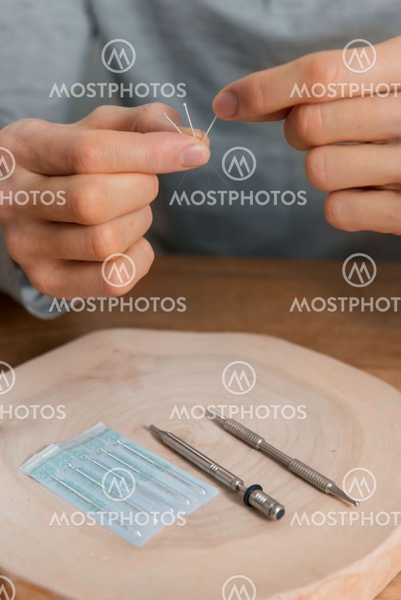Acupuncture treatment on man's hands, needles.