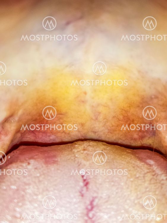 Deep Throat
