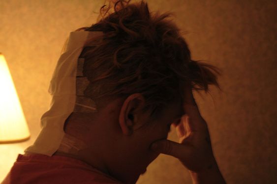 HEADACHE