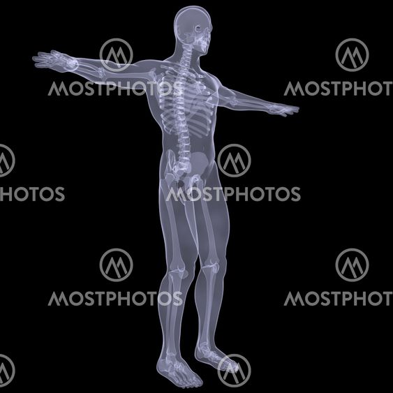 X-ray of man