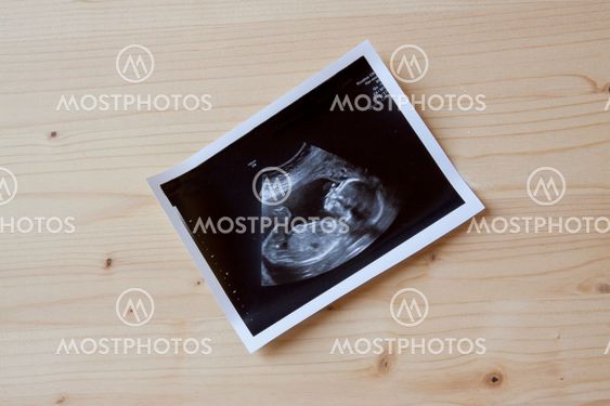 Sonogram on wood