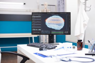 Modern pc displays brain scan in clinic