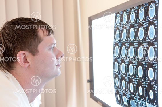 Doctor with CT scan films