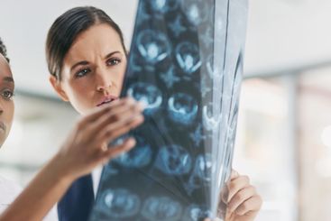 Brain scan, doctors and medical with women in hospital...