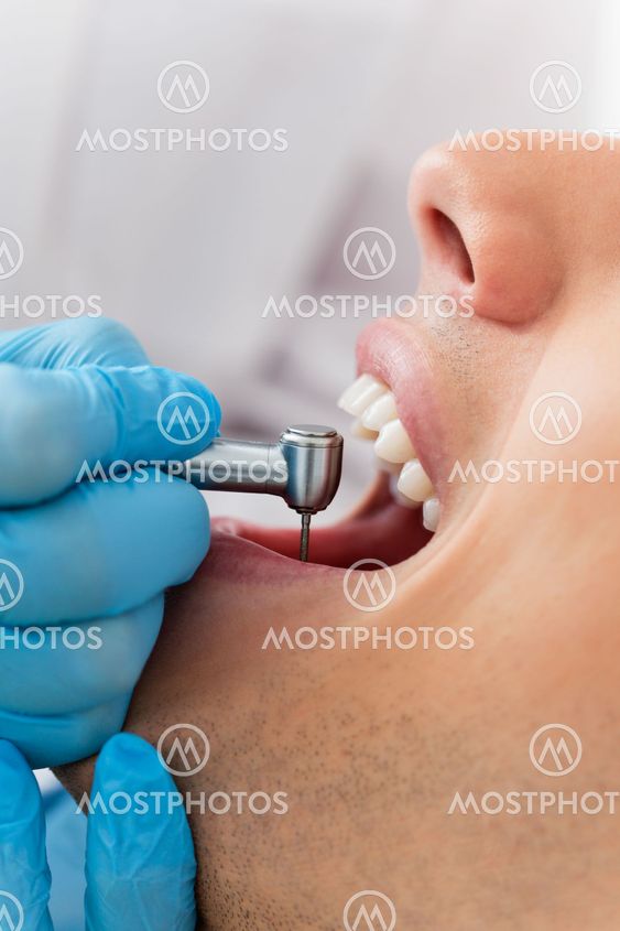 Drill Dentist