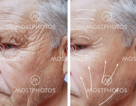 Old Man Face Wrinkles