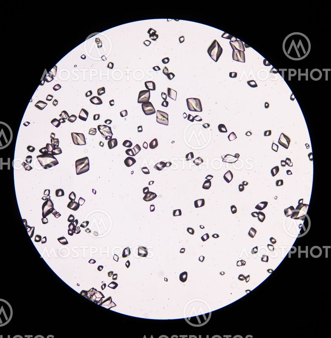 "Uric acid crystal in urine..." av Chirawan Somsanuk Mostphotos