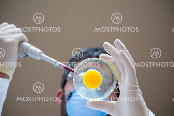 IVF performance