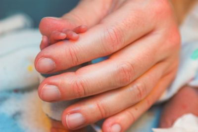 Premature Baby Holds Mother's Hand